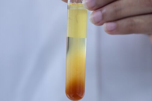 Emulsions- &  Suspensionsanalyse